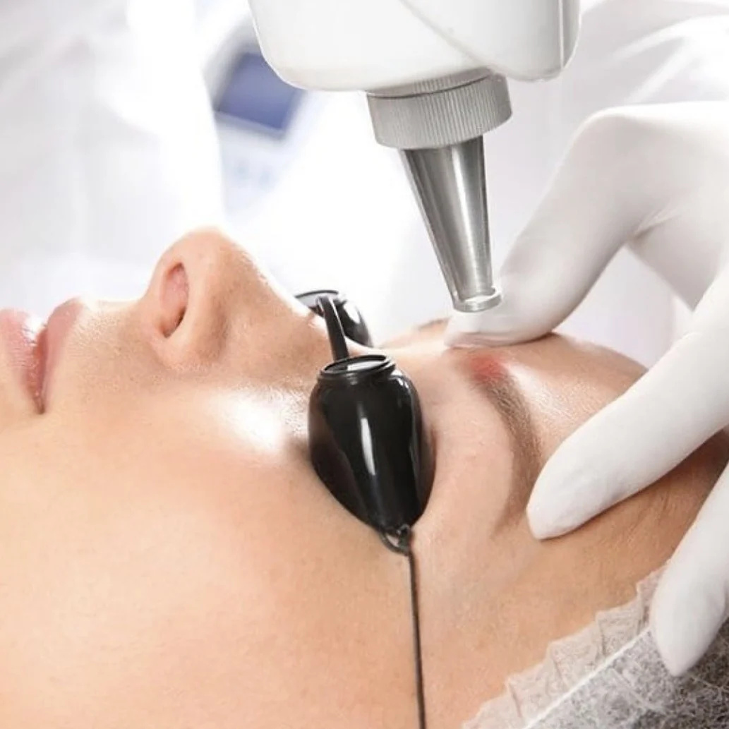 Удаление перманентного макияжа