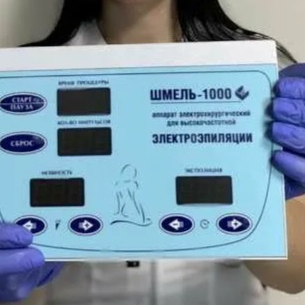 Электроэпиляция