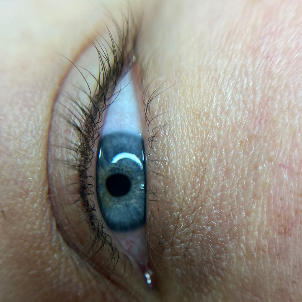 Заполнение межресничного пространства