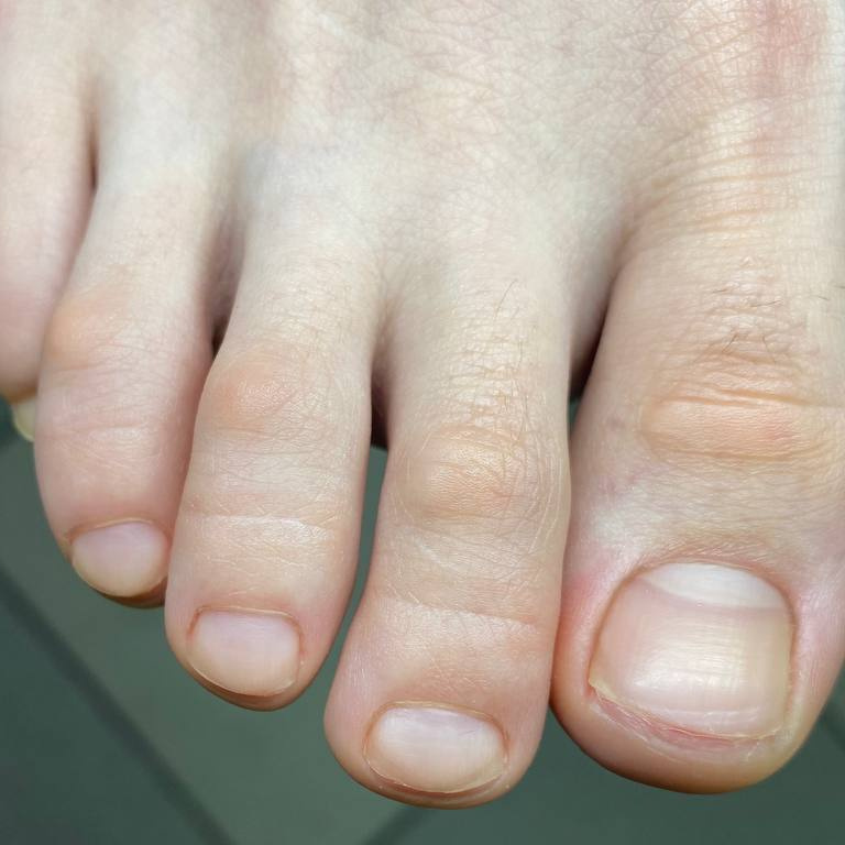 Снятие покрытия + обработка ногтей Подолог