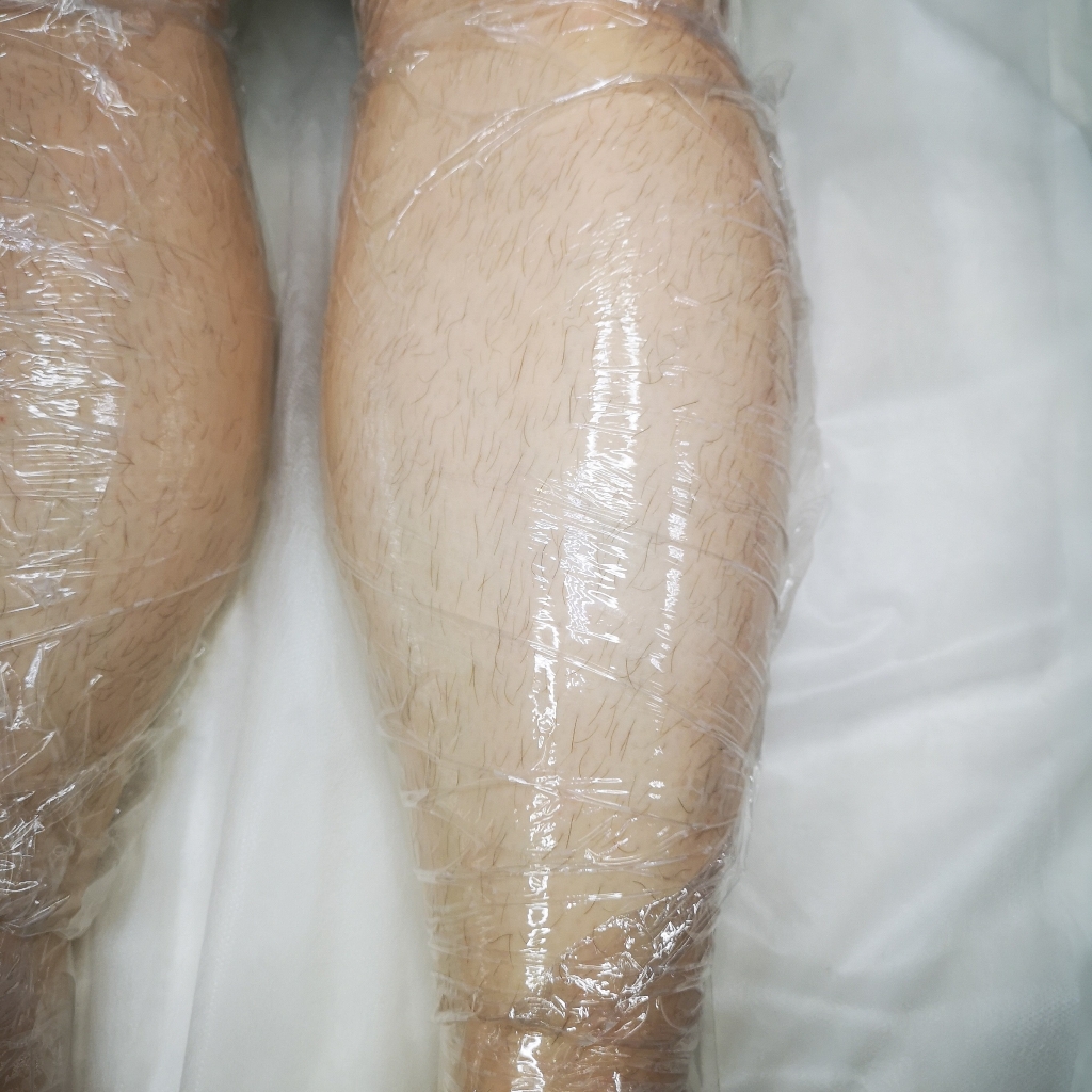 Электроэпиляция тела (Подмышки, Бикини, Руки, Ноги, Спина)