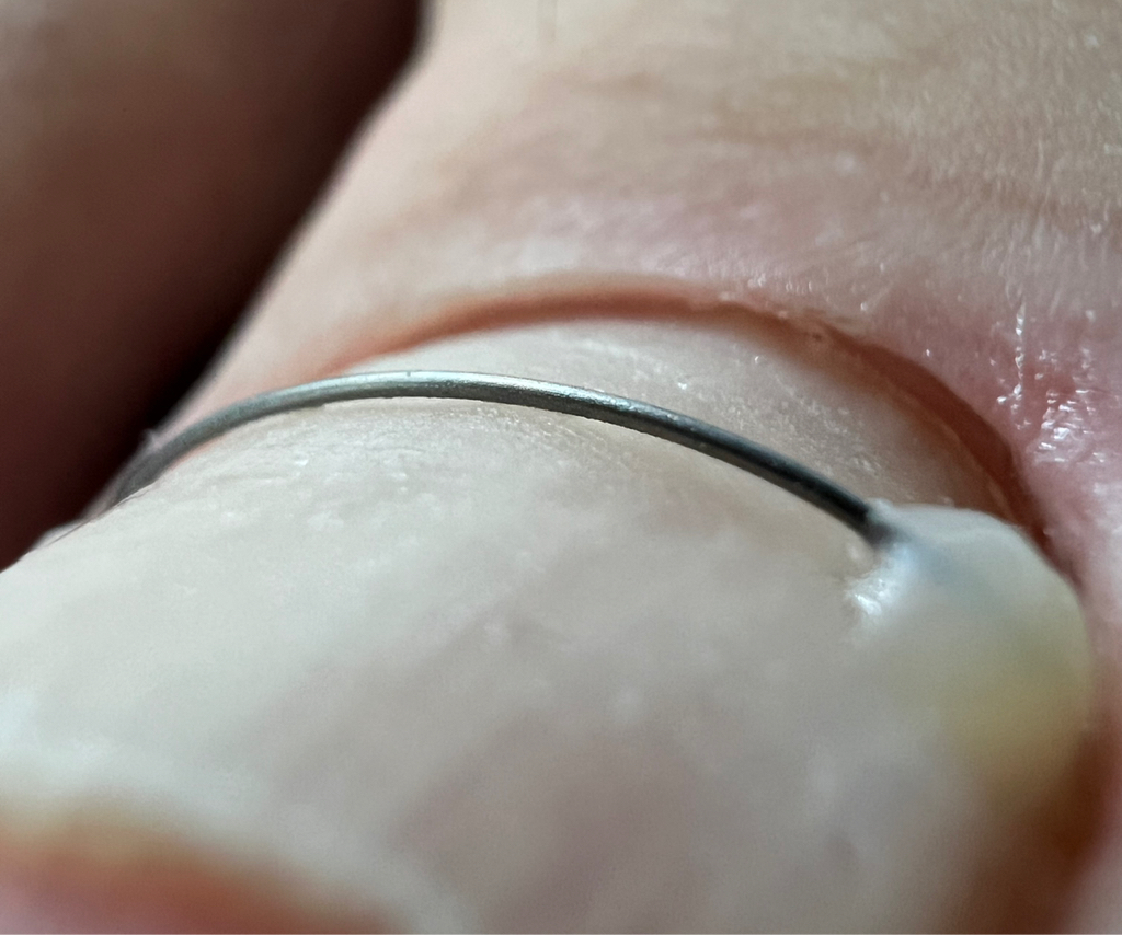 Установка Титановой нити