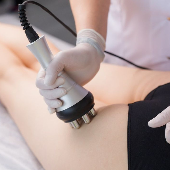 RF лифтинг тела