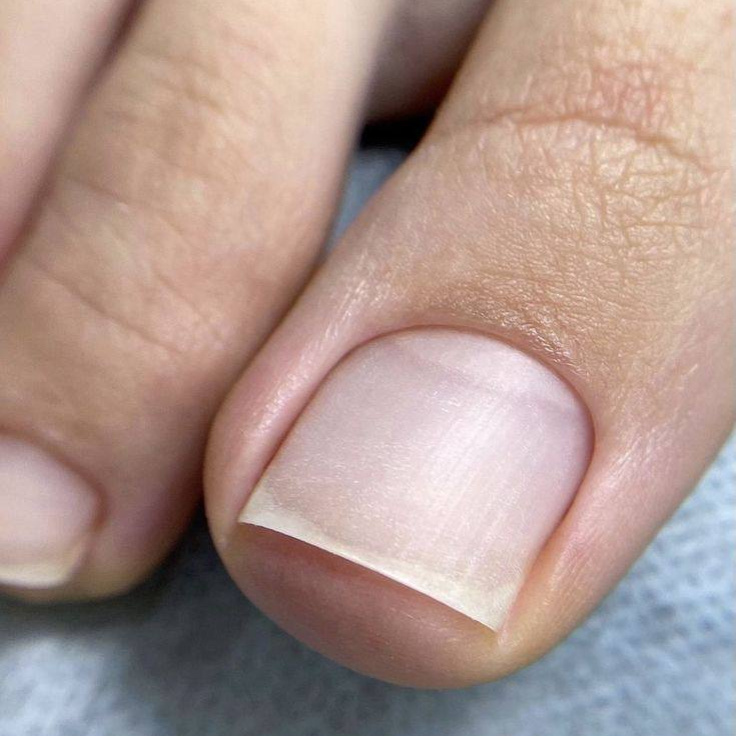 Гигиенический кислотный педикюр