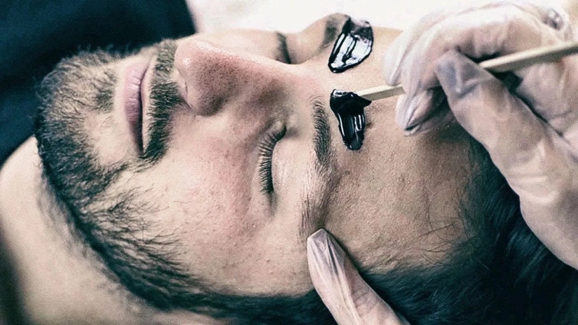 Удаление лишних волос на лице воском