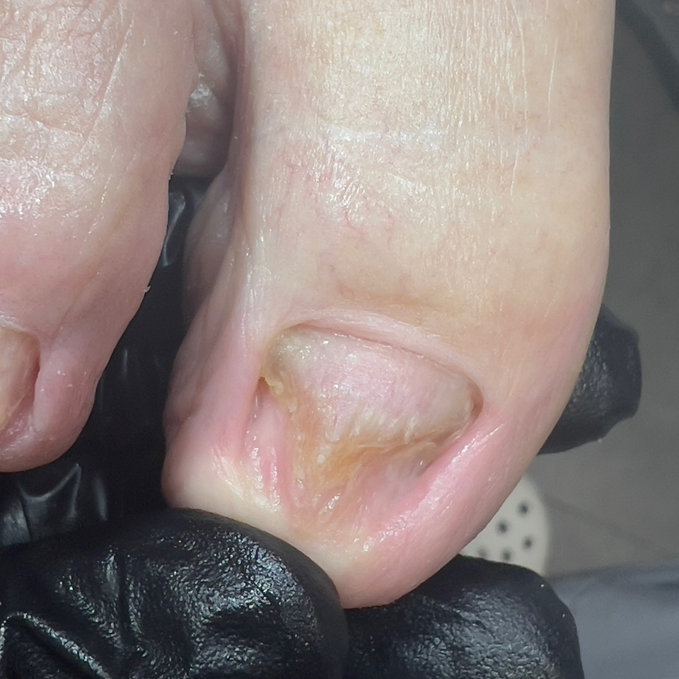 Комплексная обработка стопы (первичный или нерегулярный педикюр + консультация)