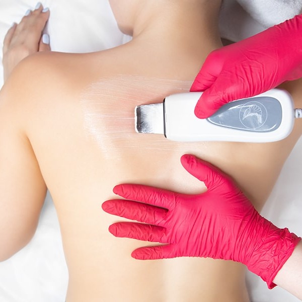 Чистка спины