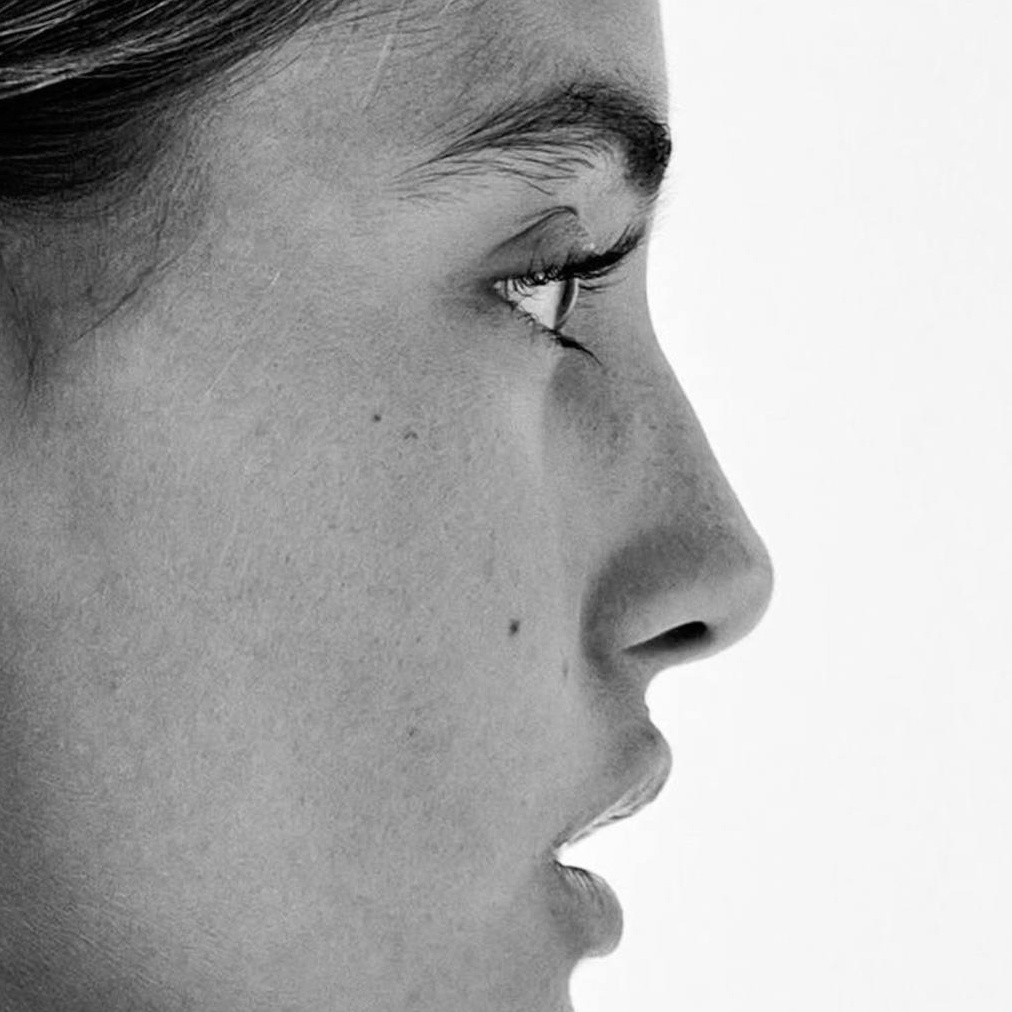 SET 6 (Комбинированная чистка +3 процедуры итальянских пилингов+ 3 процедуры микроигольчатого RF)