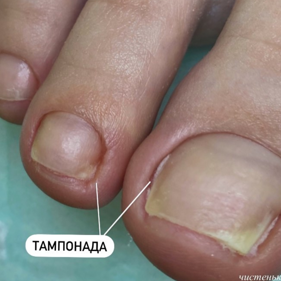 Мужской педикюр