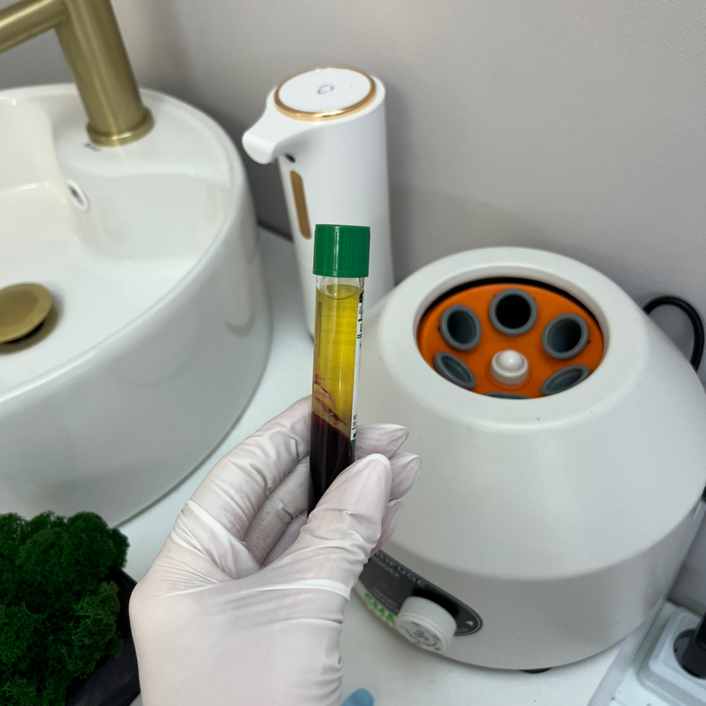 Плазмотерапия