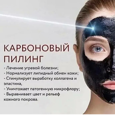 Карбоновый пилинг