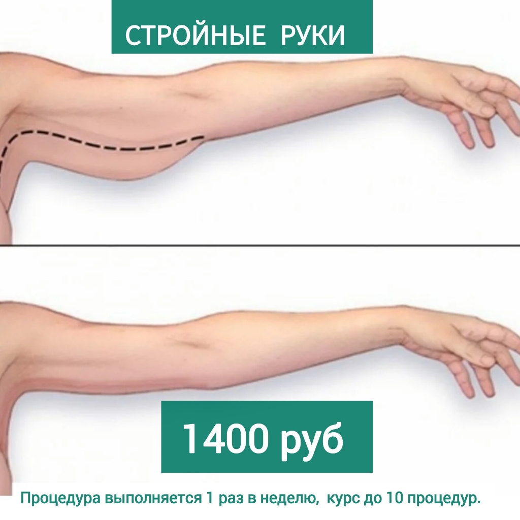 стройные руки