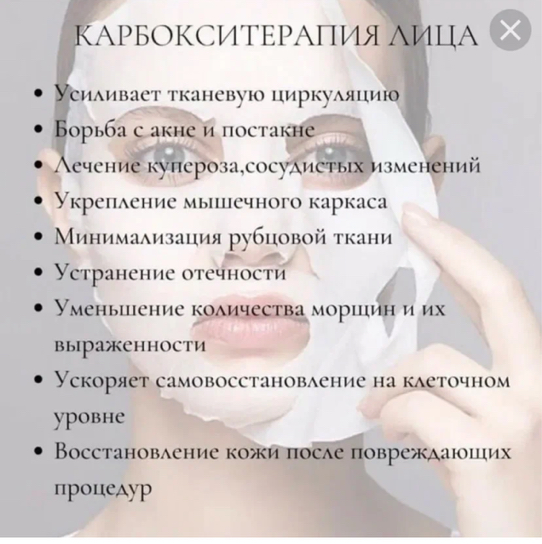 Карбокситерапия