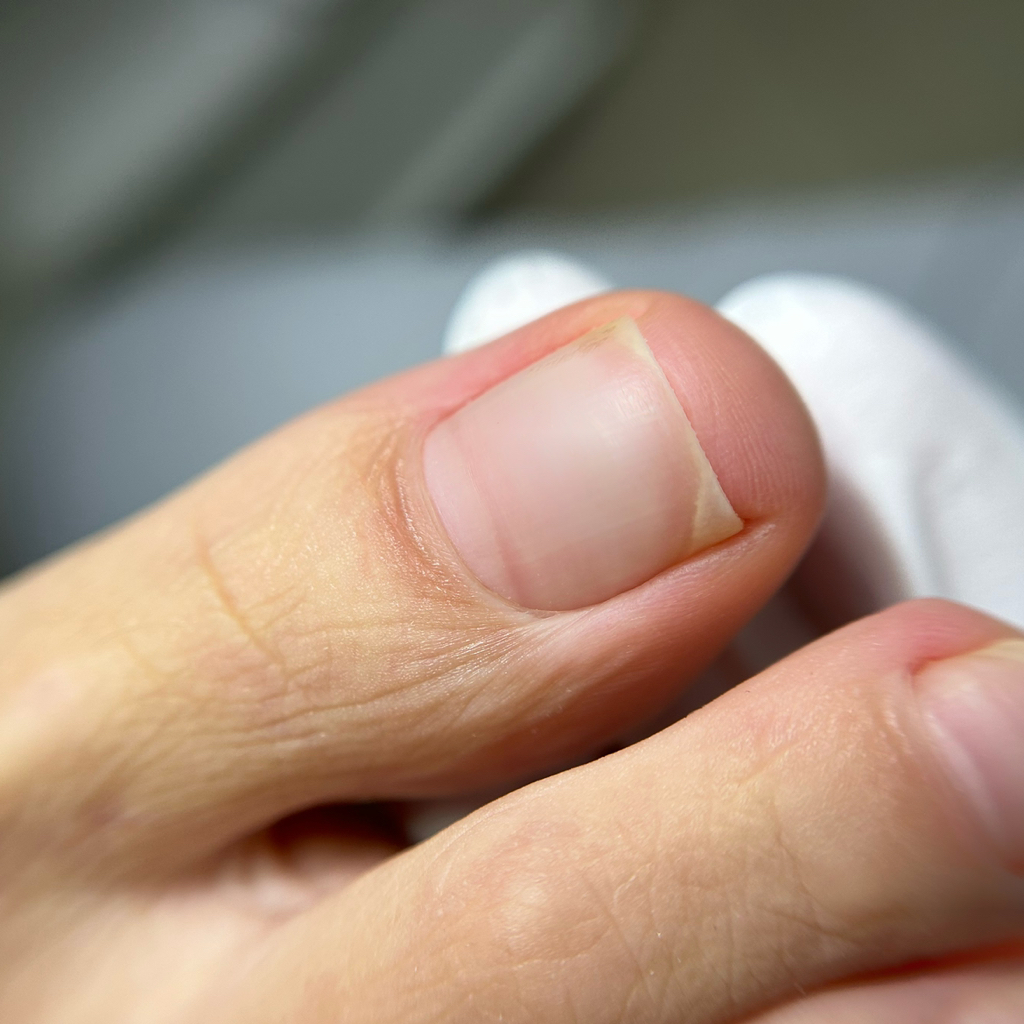 Педикюр. Только пальцы без покрытия