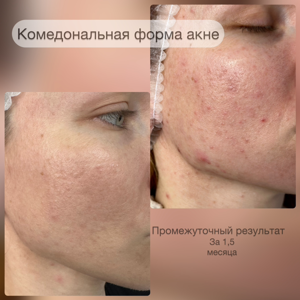 Консультация по Подбору домашнего ухода