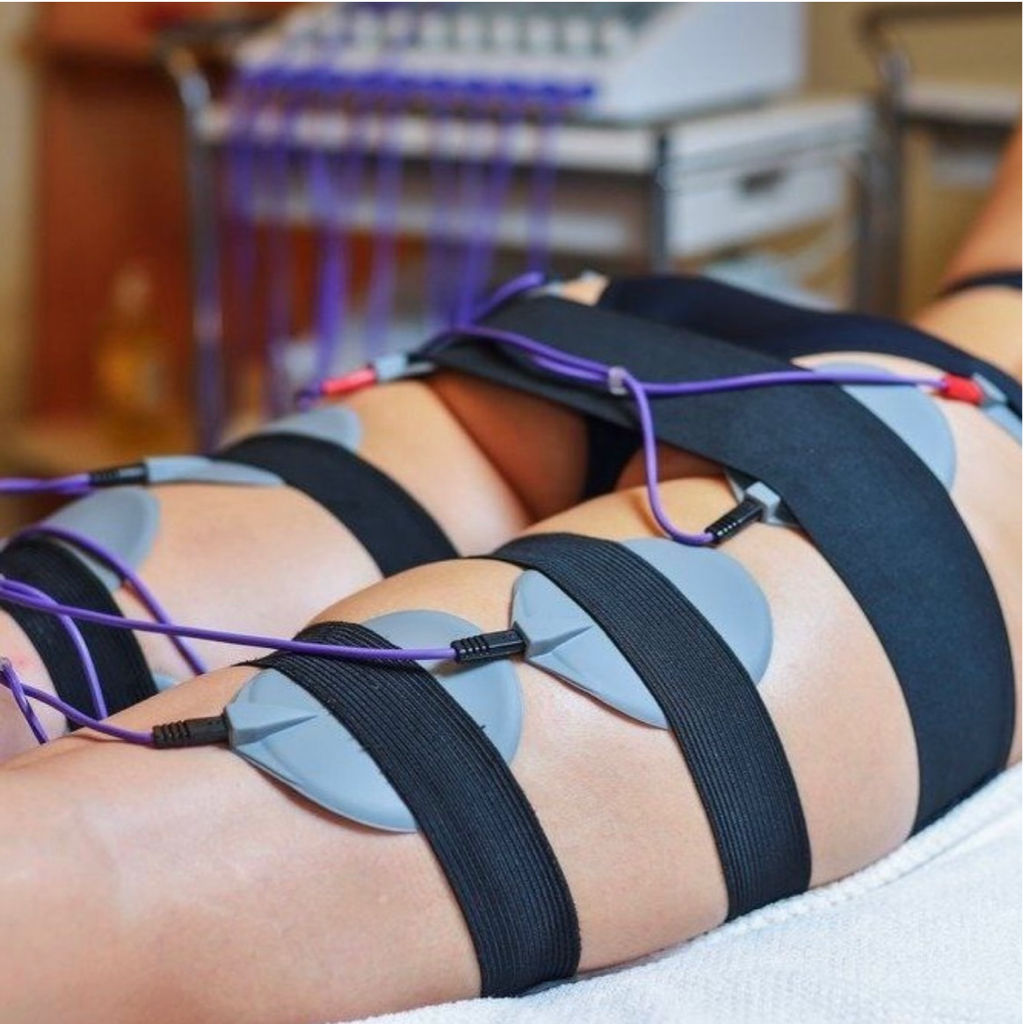 Миостимуляция