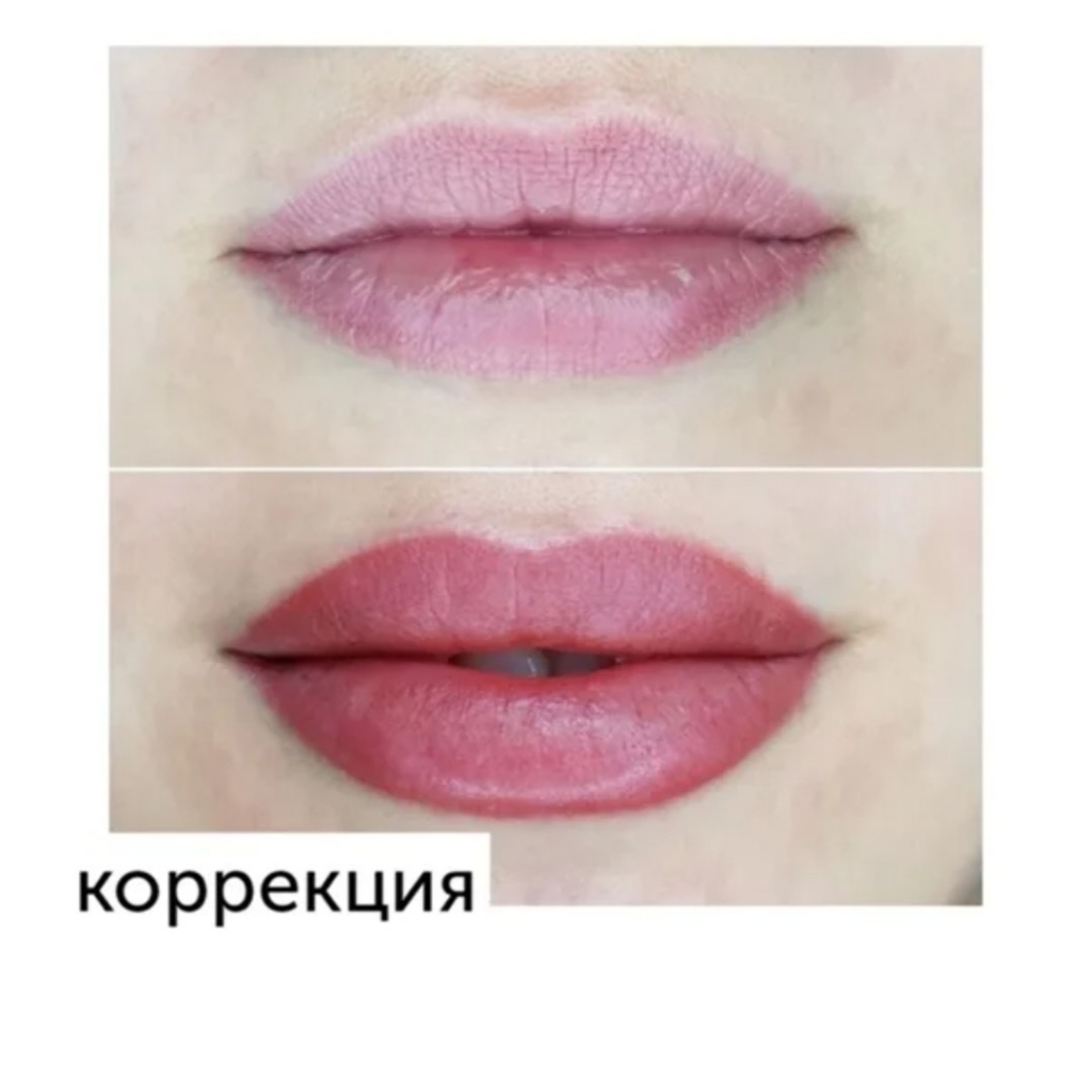 Коррекция ПМ Губ