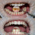 Профессиональная 5-ти этапная гигиена полости рта