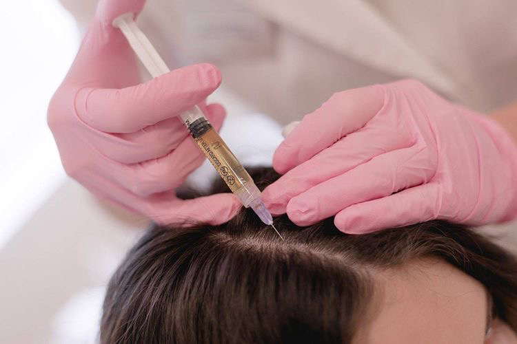 Мезотерапия (волос) препарат Fusion Mesotherapy F-HAIR