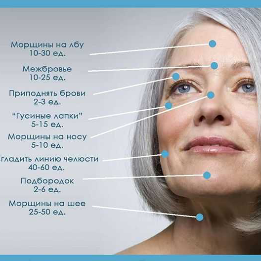 Ботулинотерапия