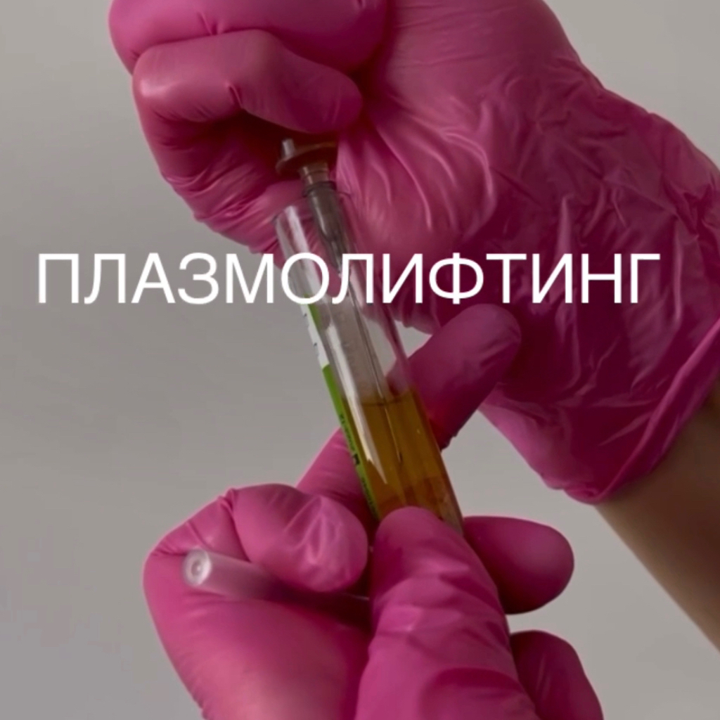 Плазмолифтинг/ PRP-терапия