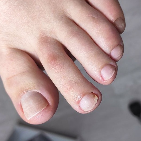 Комплекс Lite педикюр ( обработка пальчиков без покрытия)