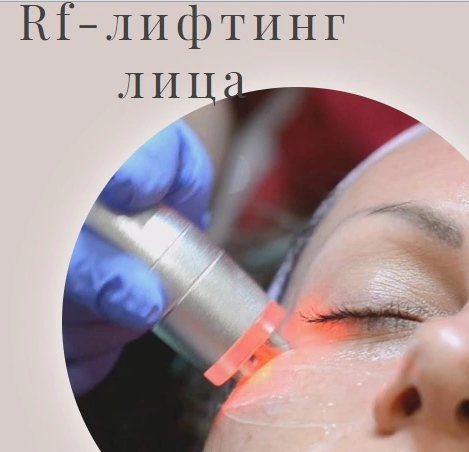Rf-лифтинг лица