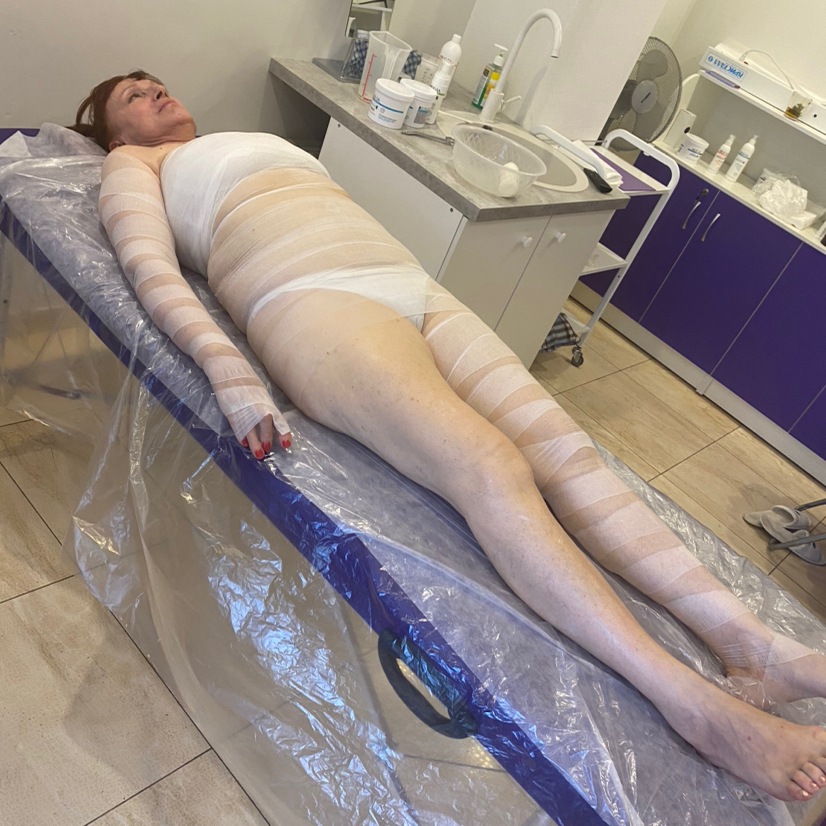 Антицеллюлитное обёртывание