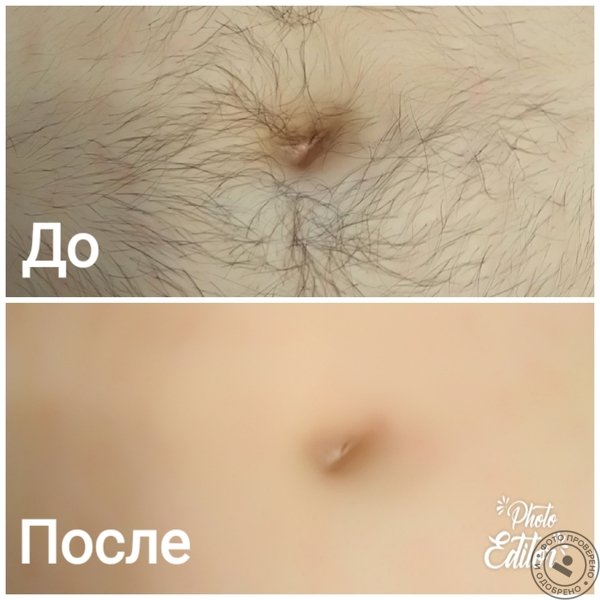 Линия живота