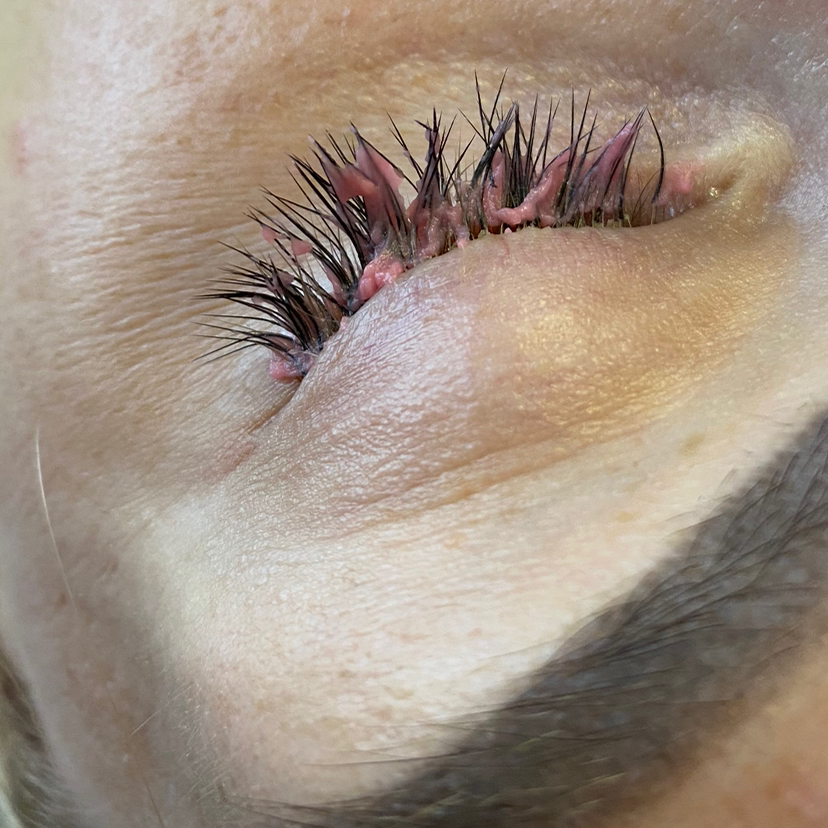 Снятие ресниц (без последующего наращивания)