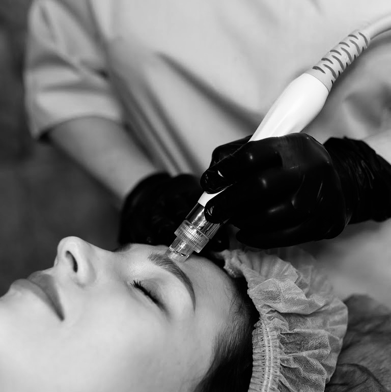 Вакуумный пилинг