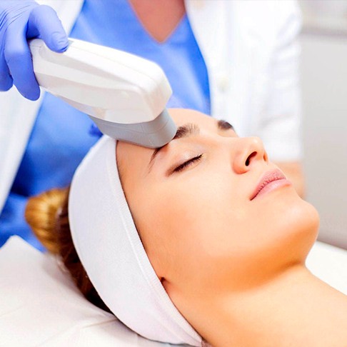 Фотоомоложение+Rf лифтинг декольте