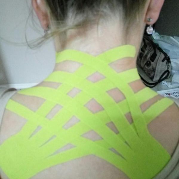 Тейпирование шеи (горбик/холка, боль)