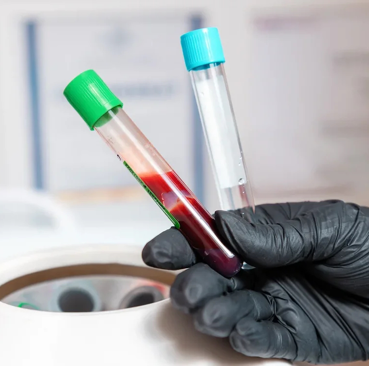 Плазмотерапия