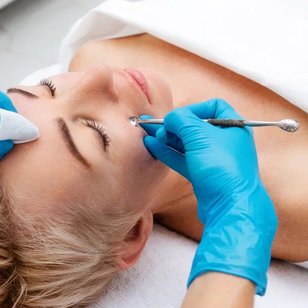 Чистка лица (механическая)