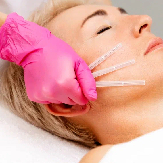 Нитевой лифтинг(коги)